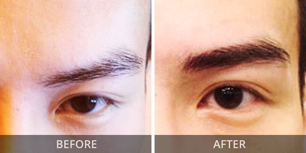 biobeauty-men-eyebrow-before-after01