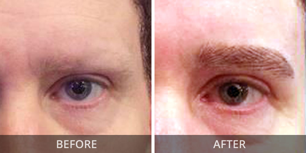 biobeauty-men-eyebrow-before-after02