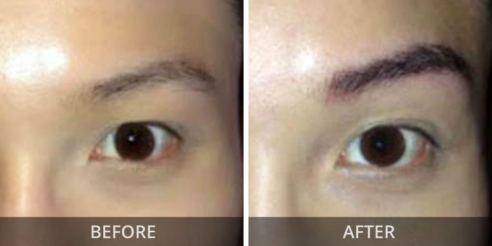 biobeauty-men-eyebrow-before-after04